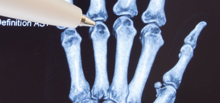 mtr-bern-austauschgruppe